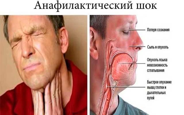 Тизанидин 2 мг 30 табл цена 126 руб в Москве, купить Тизанидин 2 мг 30 табл инструкция по применению, отзывы в интернет аптеке