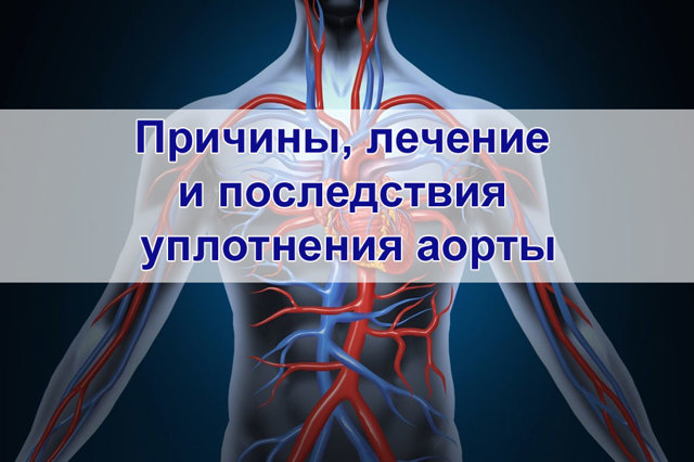 Аорта уплотнена - что это значит? Лечение уплотнения аорты