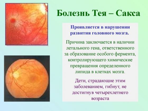 Нарушения углеводного обмена