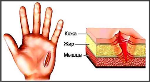 Фибринолитическая активность (в крови)