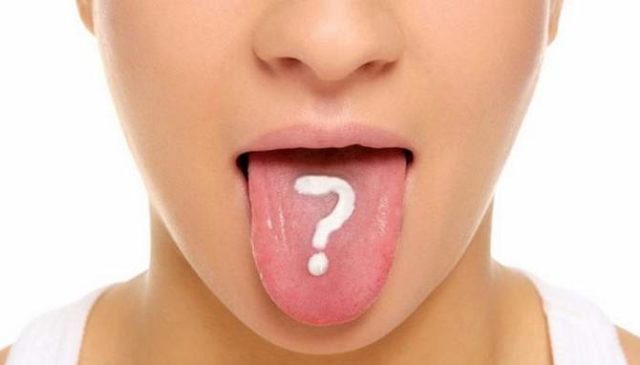 Белый налет на языке у взрослых: причины. Почему на языке белый налет, что это значит и как лечить