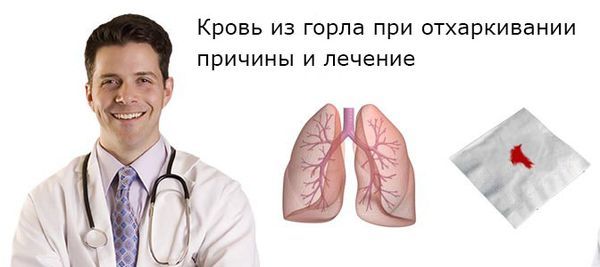 Кровь из горла при отхаркивании без кашля
