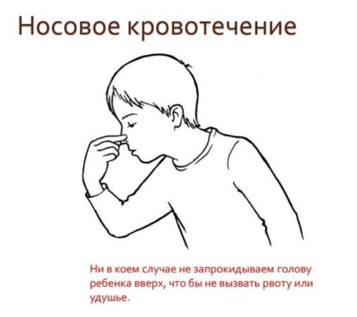 Почему идёт кровь из носа у взрослого человека. Причины и лечение народными средствами