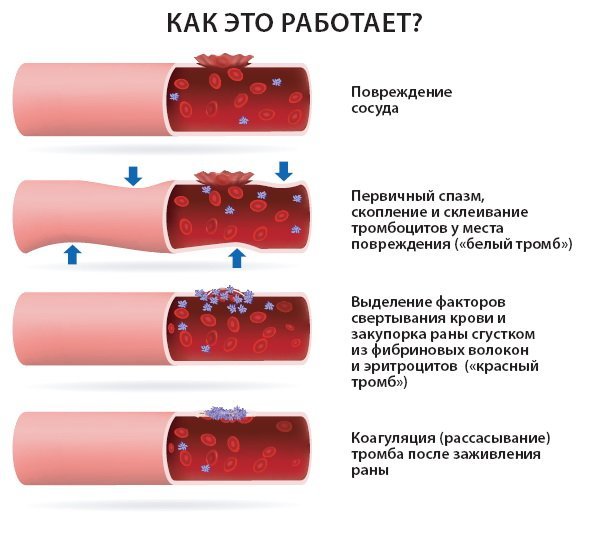 Коагулограмма: что это за анализ и как его сдавать и зачем