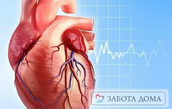 Внезапная смерть от сердечной недостаточности: причины и как этого избежать