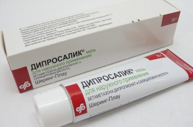 Атопический дерматит: фото, симптомы и лечение