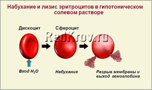 Гемолиз - это что? Гемолиз крови, частичный гемолиз