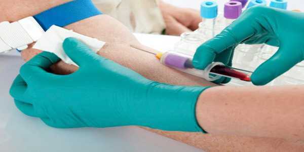 Анализ крови на билирубин - что это такое, как обозначается