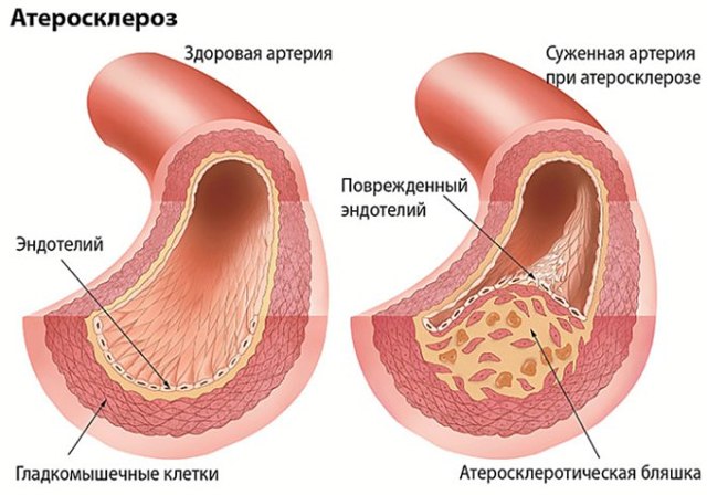УЗДГ БЦА: что это такое, показания, проведение, расшифровка результатов