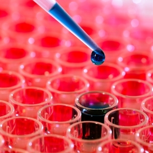 Как обозначается группа крови при сдаче анализов?