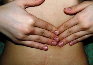 Эрозивный гастрит – симптомы, лечение, диета, осложнения, профилактика