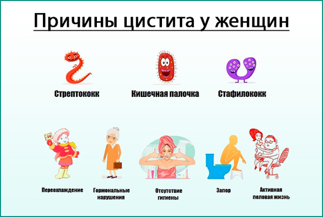Острый цистит у женщин: симптомы и лечение