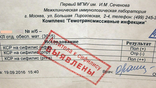 ИФА на сифилис: как проводится анализ