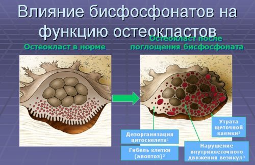 Фороза цена в Томске от 549 руб., купить Фороза, отзывы и инструкция по применению