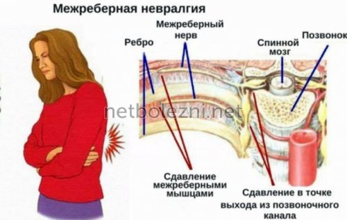 Болит и давит в грудной клетке и трудно дышать: причины боли, диагностика и лечение