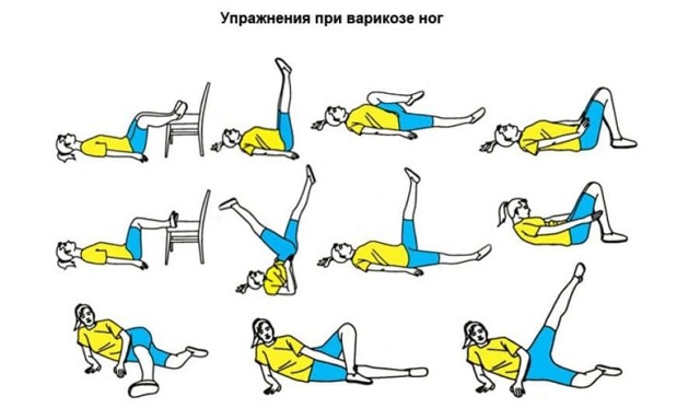 Тромбоз глубоких вен нижних конечностей лечение народными средствами