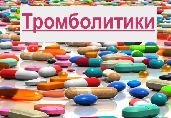 Тромб в сонной артерии: лечение, симптомы и удаление