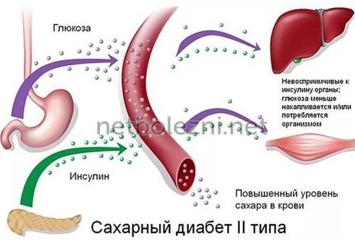 Питание при диабете 2 типа примерное меню и рекомендуемые продукты!