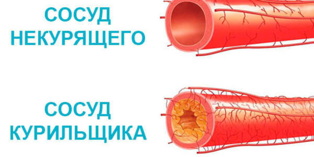 Курение повышает или понижает давление?