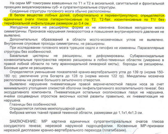 Глиозные очаги головного мозга в белом веществе