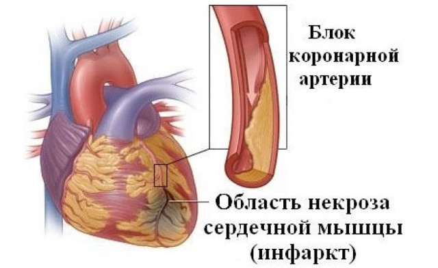 АЧТВ: расшифровка, показания к анализу