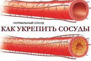 Укрепление сосудов - препараты для укрепления сосудов и капилляров