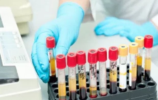 Что делать, если у ребенка повышенные эозинофилы