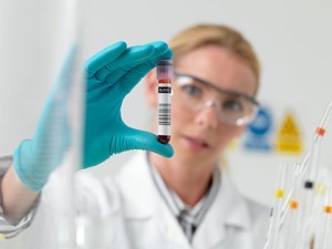 Анализ крови при лейкозе. Какие изменения в крови вызывает лейкоз. Биохимический анализ крови.