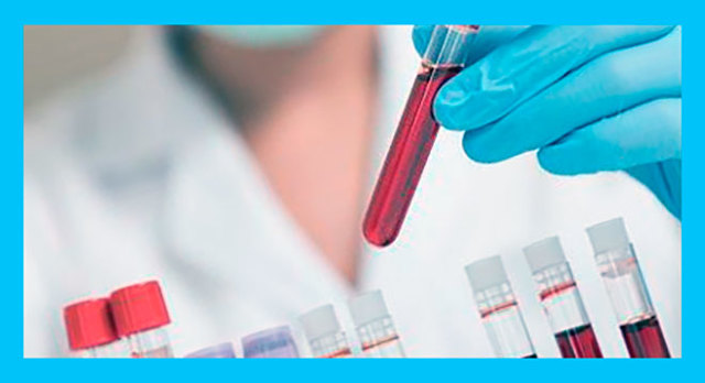 Гормон ФСГ в крови - Повышенный гормон ФСГ у женщин в лаборатории Lab4U