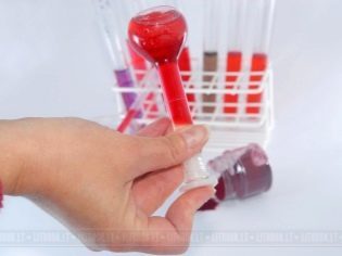 Когда покажет беременность анализ крови на ХГЧ: через сколько дней показывает, как сделать тест и на каком сроке сроке сдать анализ