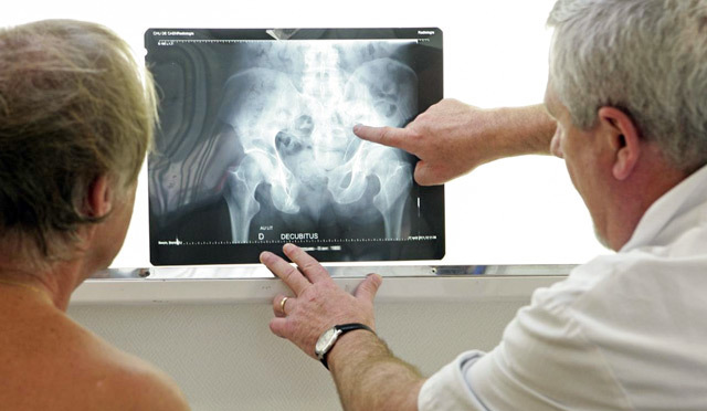 Флеболиты в малом тазу у мужчин - Все про холестерин