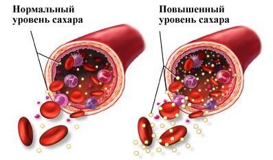 Сколько делается анализ крови на сахар | Все об эндокардите
