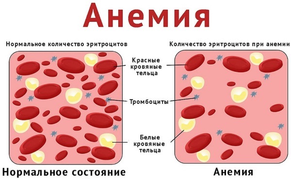 Лопнувшие капилляры на ногах: фото, как лечить и убрать, что делать? Лопаются капилляры на теле причины