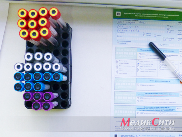 Ишемическая болезнь сердца: симптомы и лечение ишемической болезни сердца, что это такое и чем оно опасно для человека