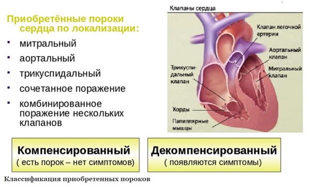 Приобретенный порок сердца