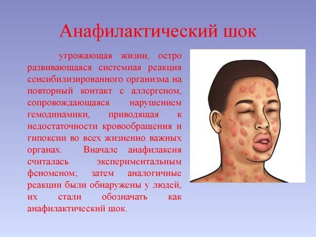 Первая помощь при шоке - симптомы и причины шока