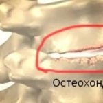 Цель Т инструкция, отзывы, цена, описание