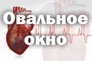 Открытое овальное окно в сердце: у взрослого, что означает