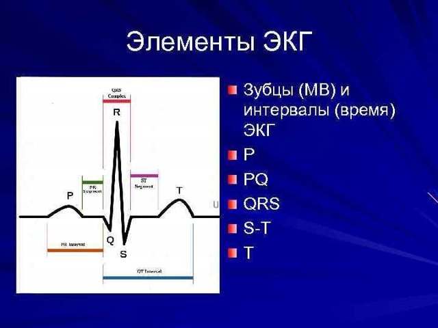 ЭКГ — что это такое, как его делают и что означают его показатели?