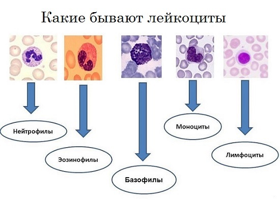 Норма лейкоцитов в крови у женщин: особенности и причины отклонений