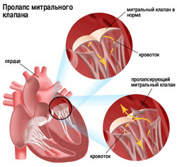 Атриовентрикулярная проводимость Википедия