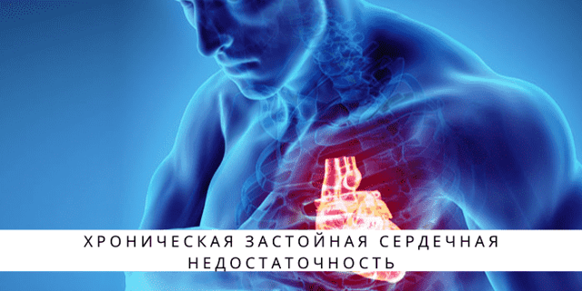 Хроническая застойная сердечная недостаточность: симптомы и лечение
