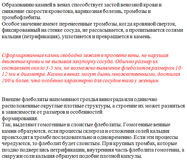 Флеболиты в малом тазу у мужчин - Все про холестерин