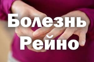 Болезнь Рейно – симптомы у женщин. Болезнь и синдром Рейно – причины, диагностика, лечение, прогноз