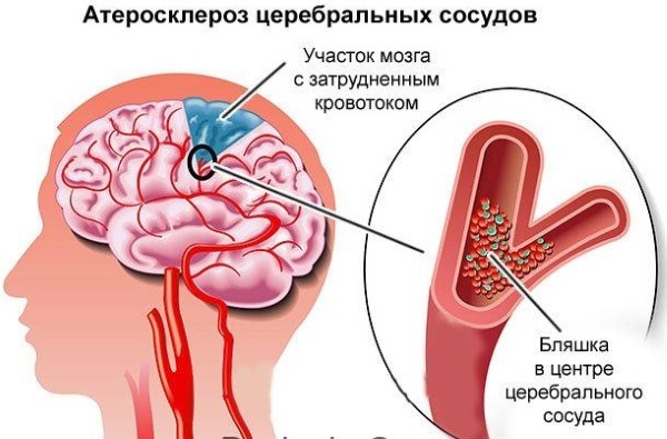 Витапрост - 11 отзывов, инструкция по применению