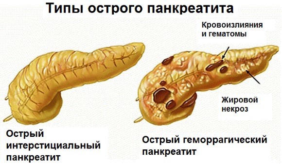 Как снизить пульс в домашних условиях быстро
