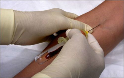 Консультации онлайн. Из какого пальца брать кровь на сахар для глюкометра