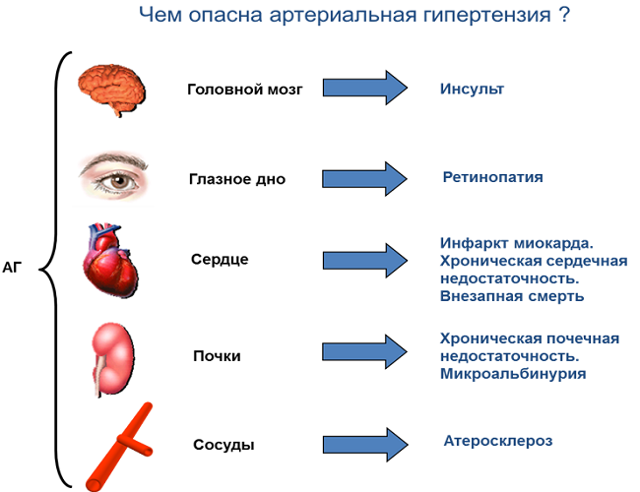 Что такое Артериальная гипертензия?