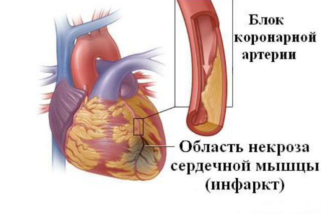 Норма аст и алт: результаты, расшифровка, отклонения