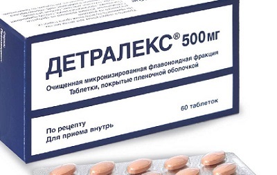 Дилатация вен малого таза - Варикоз